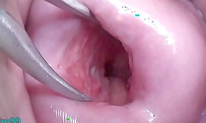 Japanese Wife Open Cervix Wide at hand keep in view inside Uterus